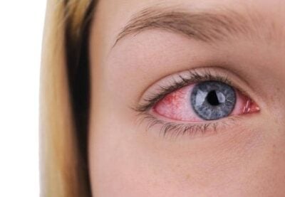 Rote Kiffer Augen