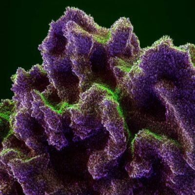 Indica - Medizinische Cannabisblüten